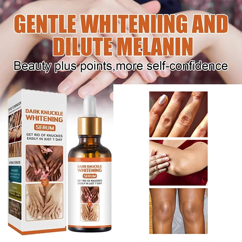 Skin Whitening Cream-2