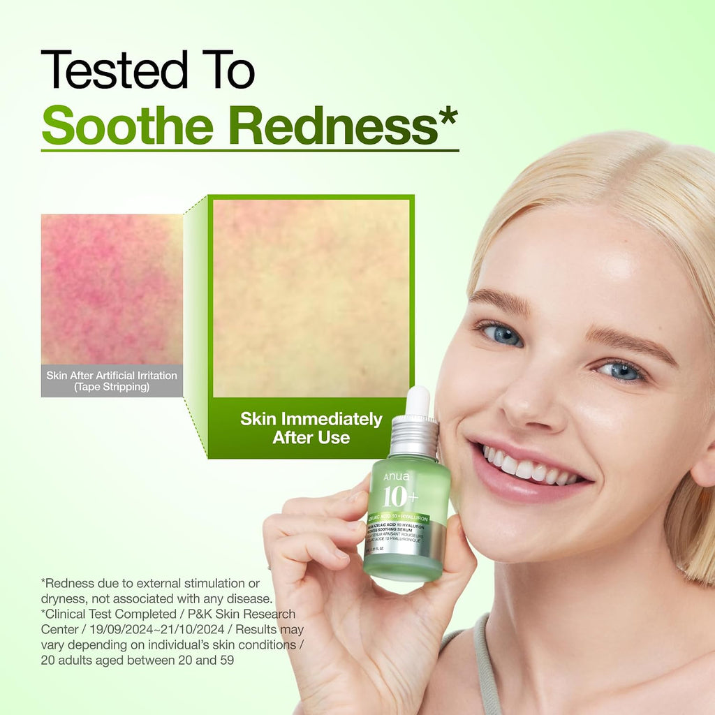 Anua Azelaic Acid 10 Hyaluron Redness Soothing Serum, 1.01 fl oz - Jansha Store