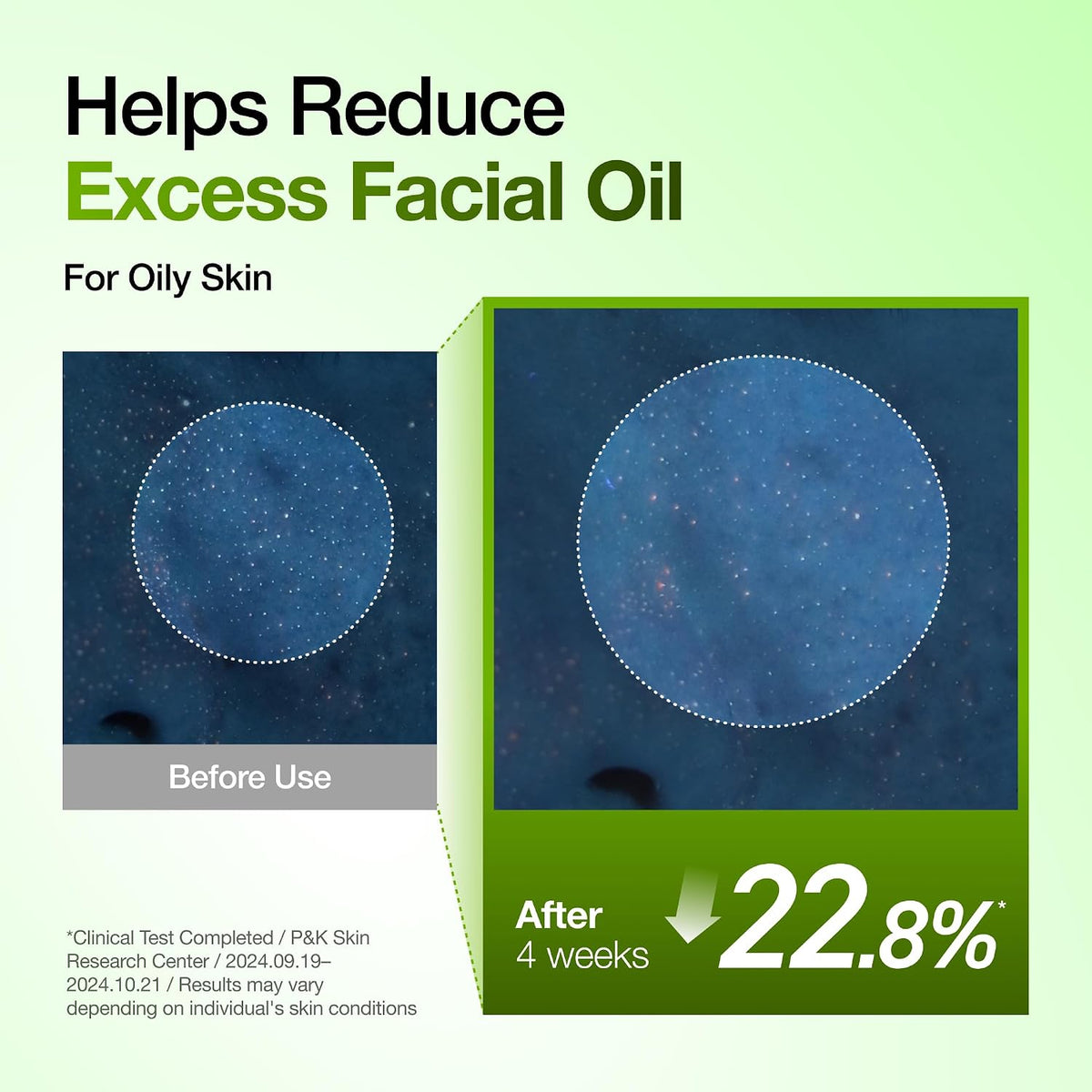 Anua Azelaic Acid 10 Hyaluron Redness Soothing Serum, 1.01 fl oz - Jansha Store