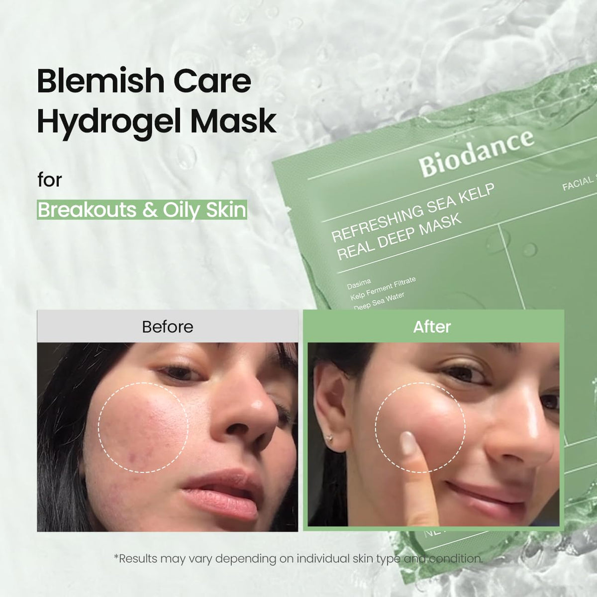 BIODANCE Bio-Collagen Real Deep Mask, Hydrating Overnight Hydrogel Face Mask, Pore Minimizing, Elasticity, Plumping, Travel Essentials & Self Care Gifts for Women, Korean Skin Care | 1.19oz(34g) x 4ea - Jansha Store