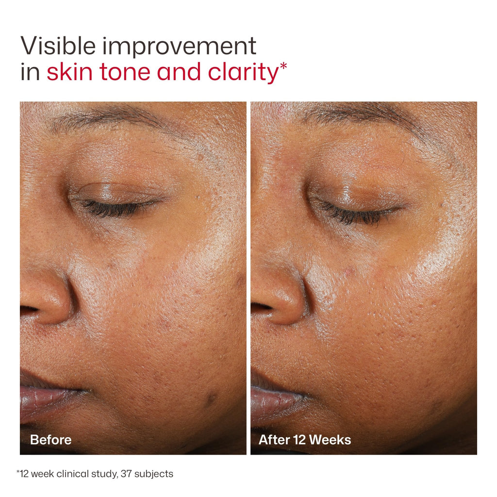 EltaMD UV Clear Face Sunscreen with Zinc Oxide, Oil-Free, SPF 46 and SPF 50 - Jansha Store