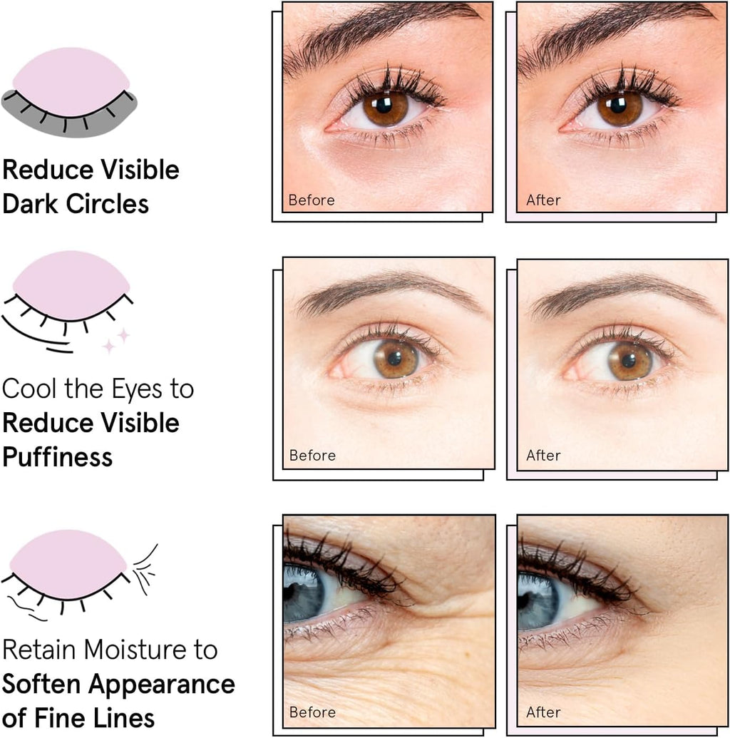 grace & stella Award Winning Eye Patches for Puffy Eyes - Birthday Gifts for Women - Under Eye Mask for Dark Circles and Undereye Bags - Gifts for Mom - Vegan Cruelty-Free Self Care (24 Pairs, Gold) - Jansha Store
