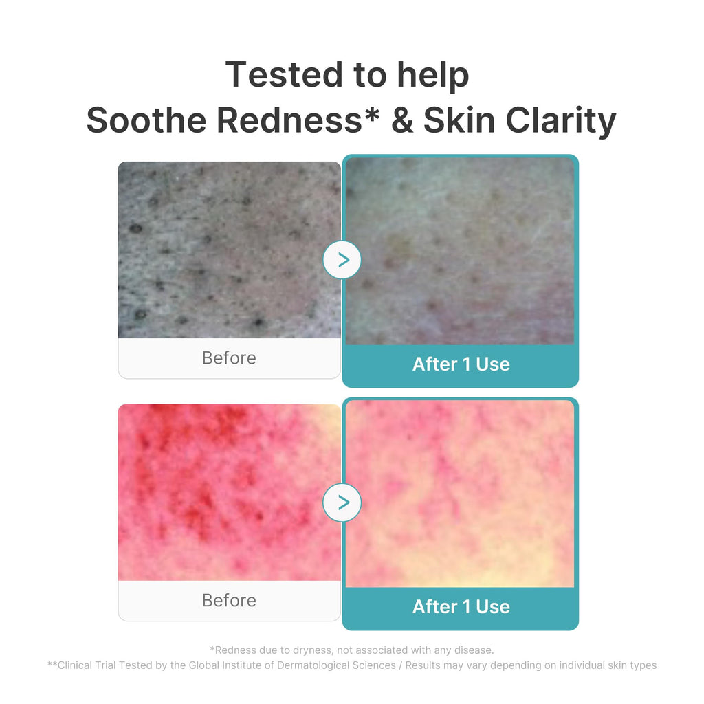 medicube Facial Cleanser Zero Pore Capsule Foam Cleanser - Jansha Store