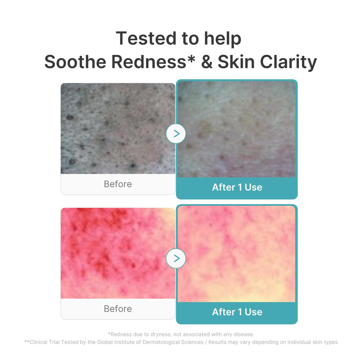 medicube Facial Cleanser Zero Pore Capsule Foam Cleanser - Jansha Store