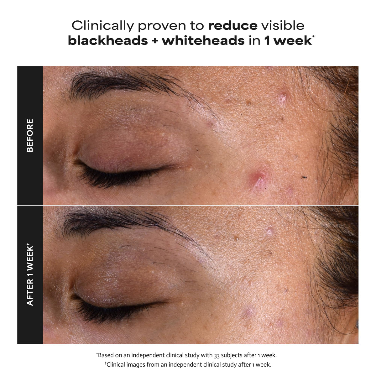 Paula's Choice SKIN PERFECTING 2% BHA Liquid Leave-On Exfoliant - Jansha Store