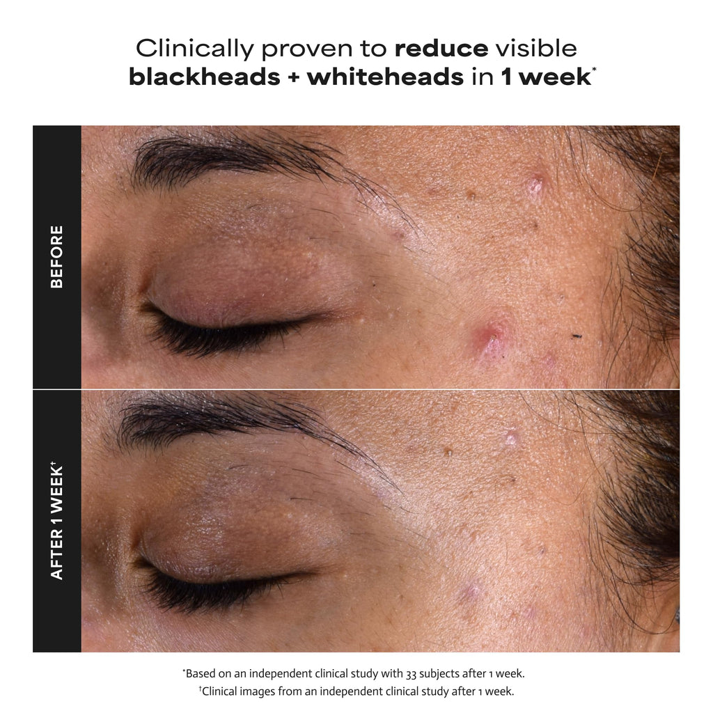 Paula's Choice SKIN PERFECTING 2% BHA Liquid Leave-On Exfoliant - Jansha Store