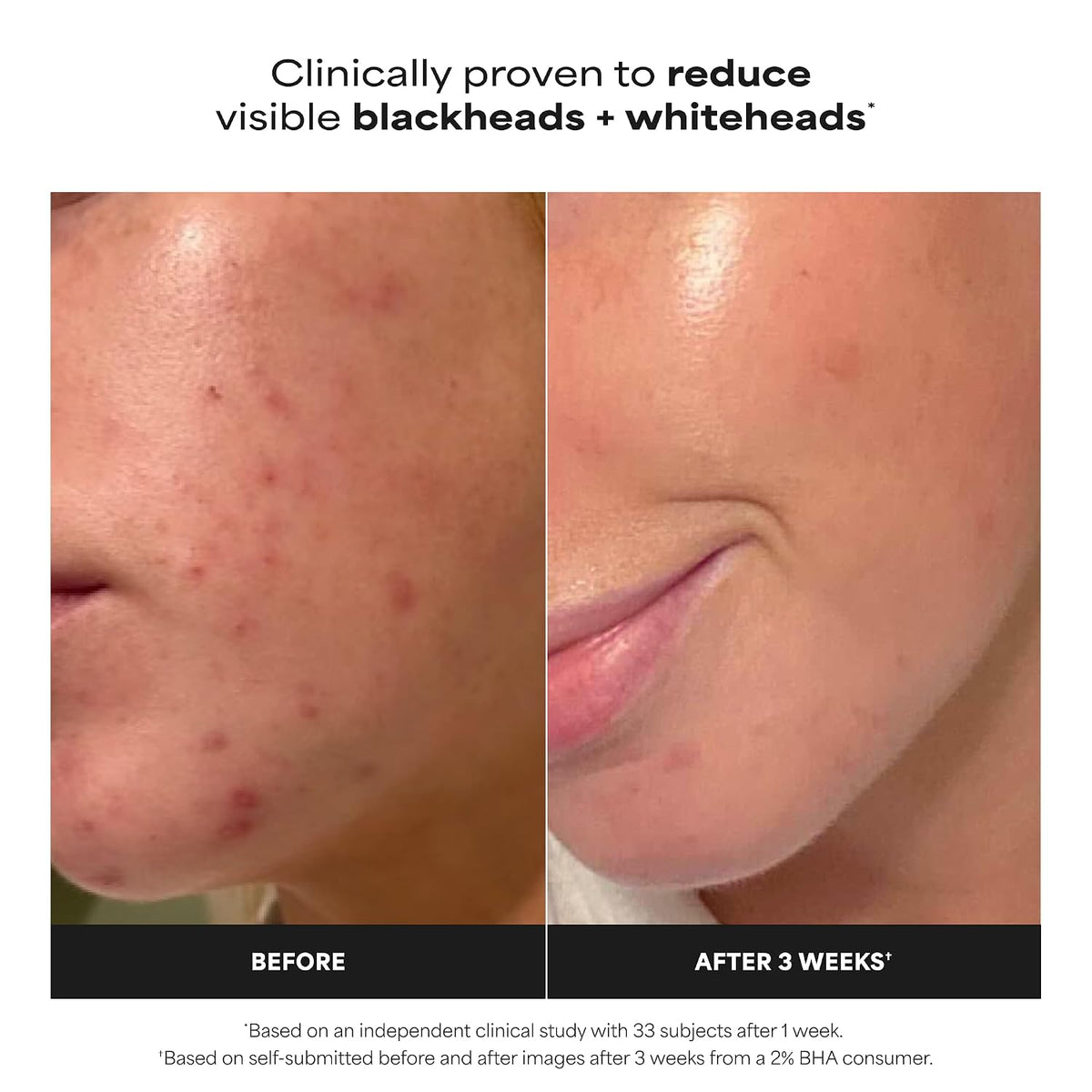 Paula's Choice SKIN PERFECTING 2% BHA Liquid Leave-On Exfoliant - Jansha Store