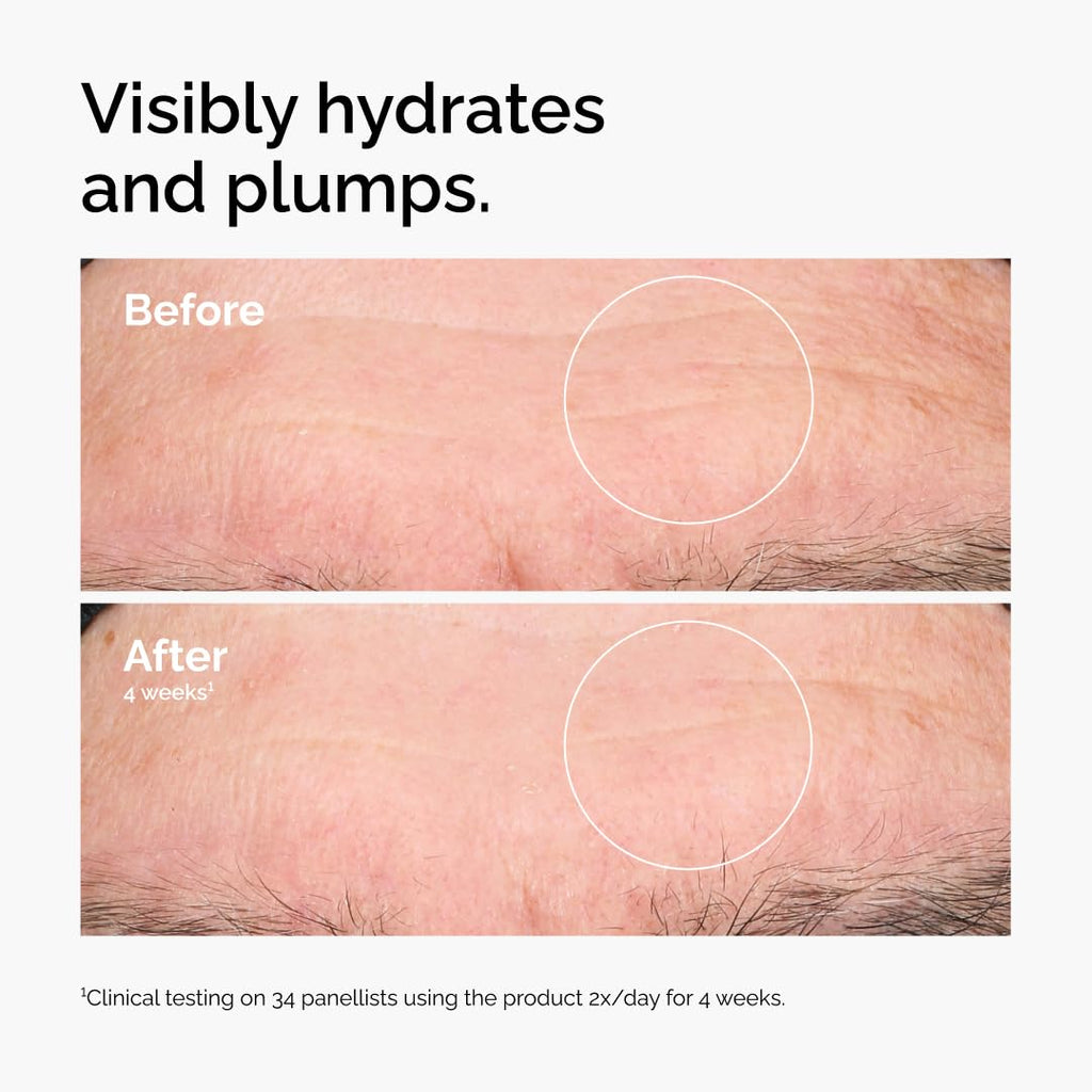 The Ordinary Hyaluronic Acid 2% + B5 (with Ceramides), Multi-Depth Hydration Serum for Plumper, Smoother Skin - Jansha Store