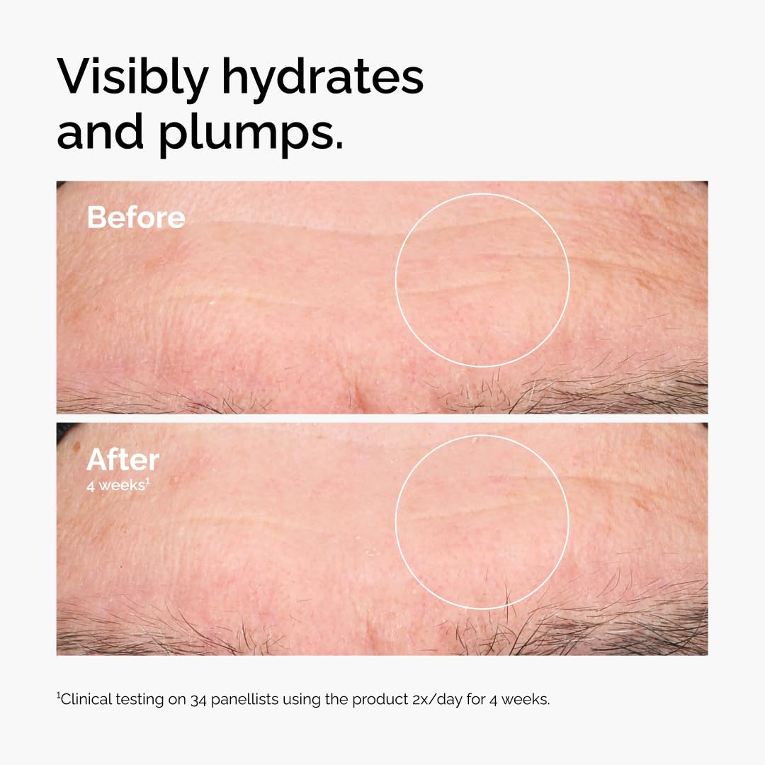The Ordinary Hyaluronic Acid 2% + B5 (with Ceramides), Multi-Depth Hydration Serum for Plumper, Smoother Skin - Jansha Store